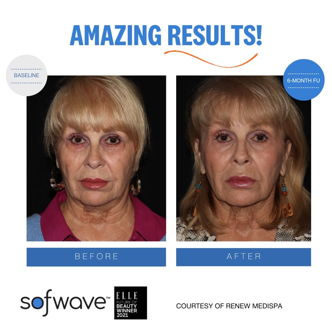 Complete Face & Neck