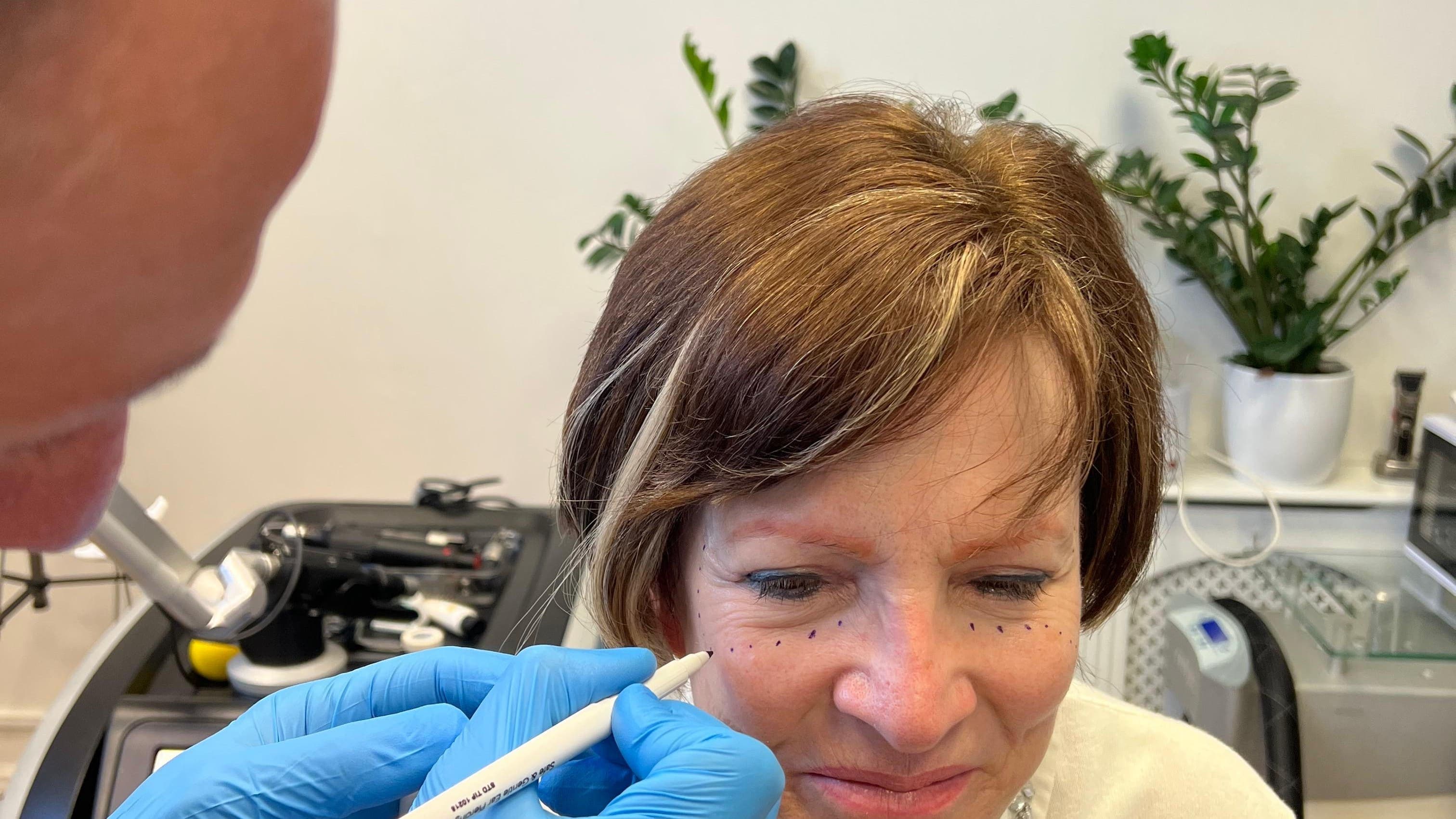 Follow-Up & Maintenance