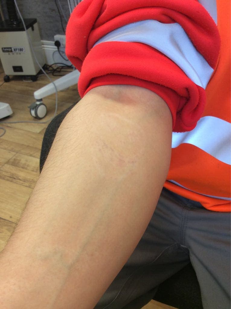 After treatment