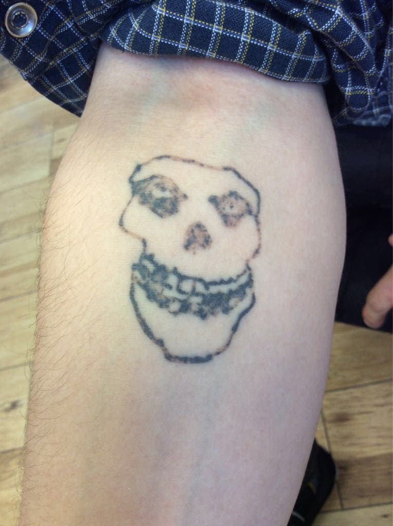 Before treatment