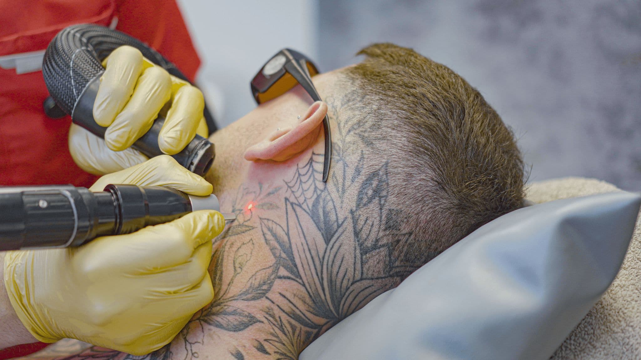 PicoSure Pro Laser Tattoo Removal