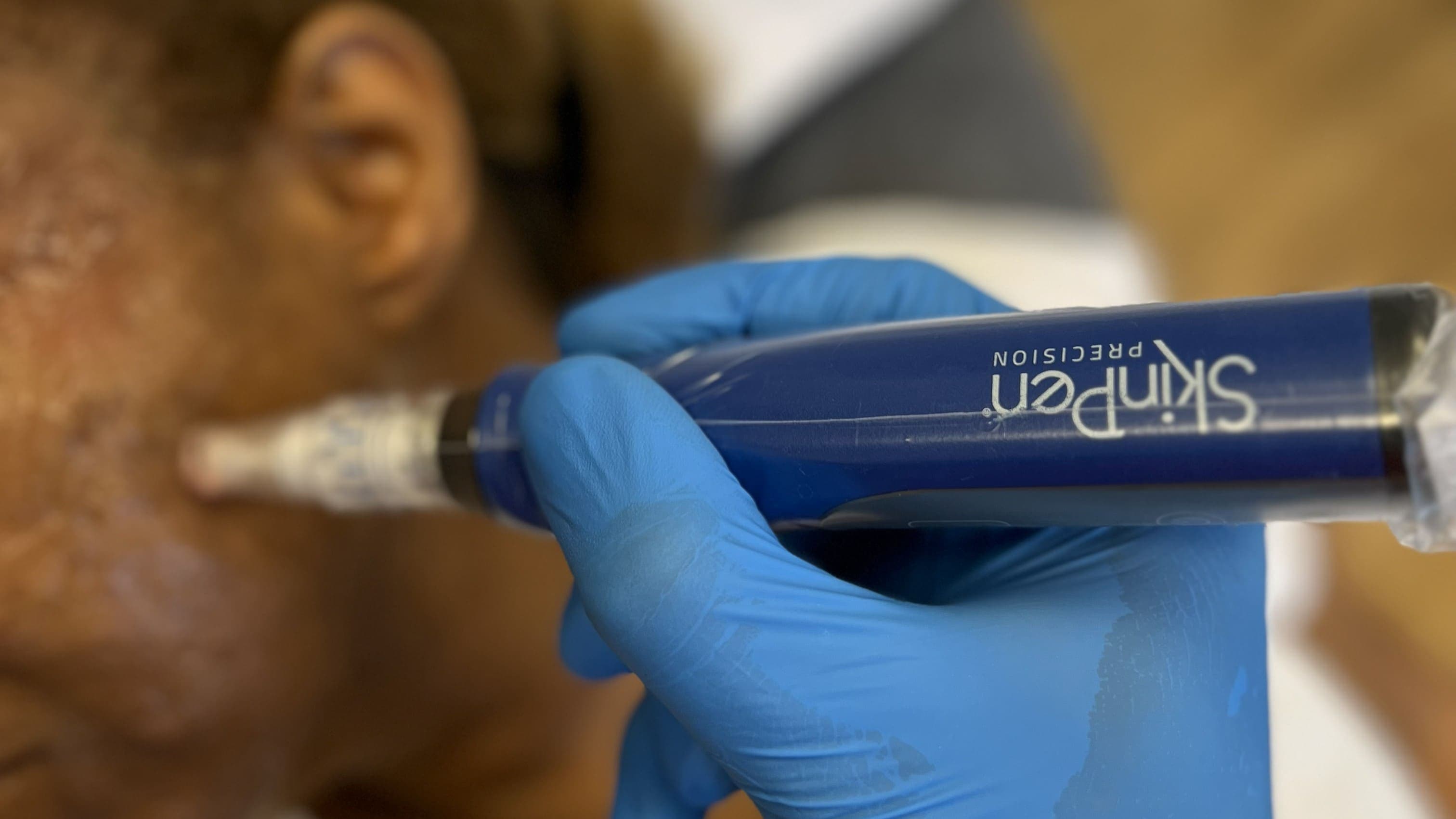 Advanced Treatment