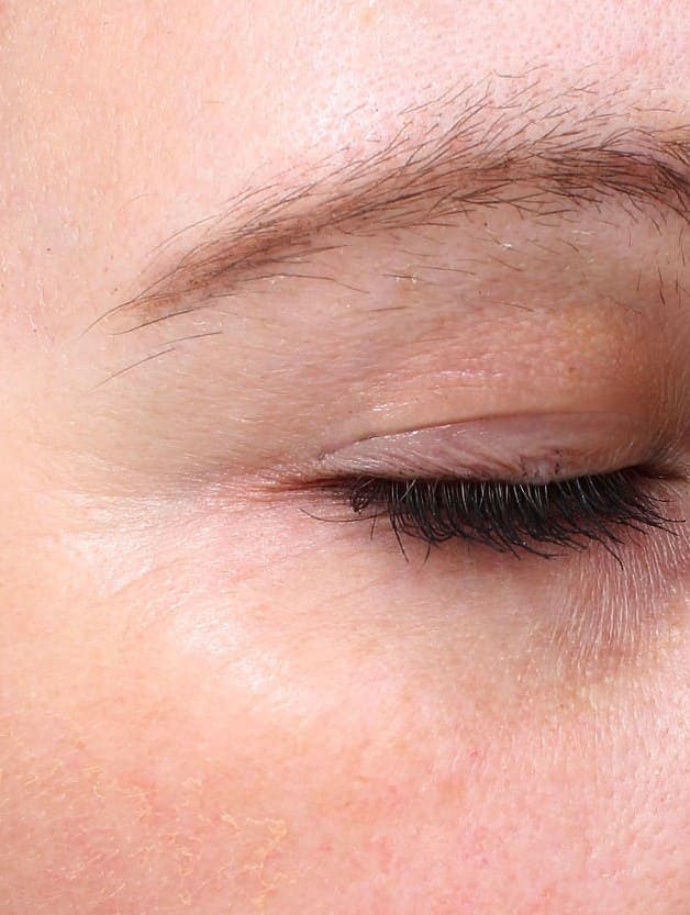 After treatment